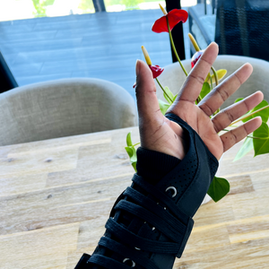 I Broke My Wrist: My Journey Through Distal Radius Fracture Recovery